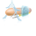 Andropenis Mini - Extensor De Pénis